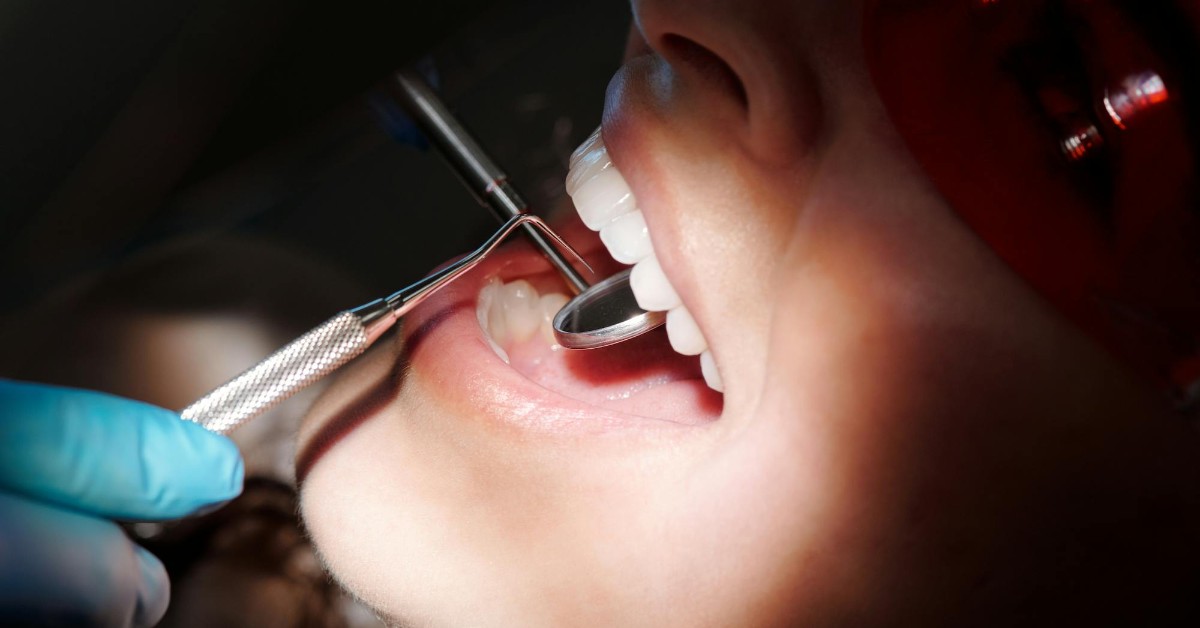 How to Avoid Complications After Dental Implants