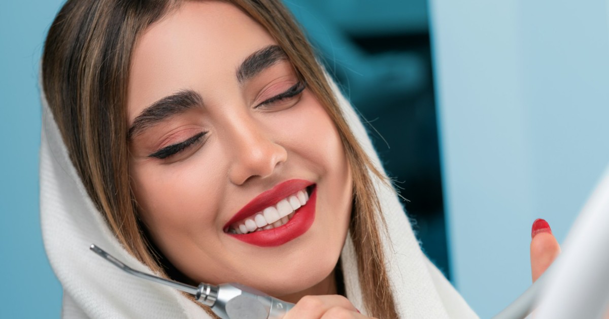 5 Benefits of Dental Veneers